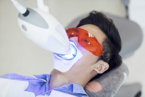 Laser Tooth Whitening